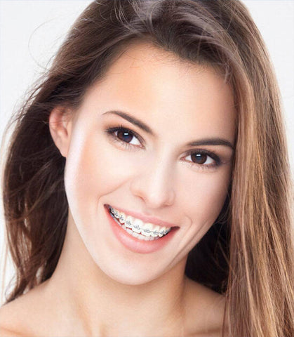 ¡Mejora tu sonrisa! Ortodoncia (colocación de minibrackets nuevos) + Limpieza dental