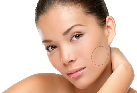 Reducción de papada y Bolsas de bichat